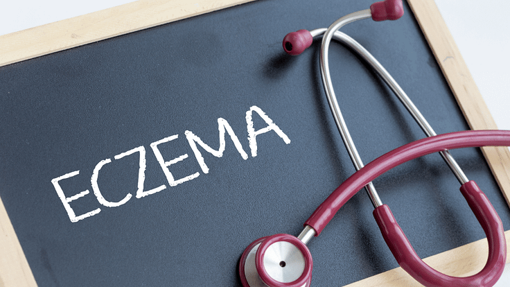 Causes, Types and Treatment of Eczema Disease